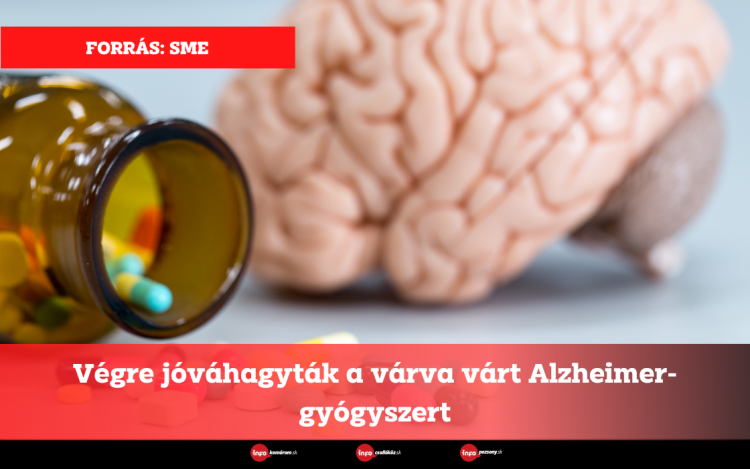 Végre jóváhagyták a várva várt Alzheimer-gyógyszert