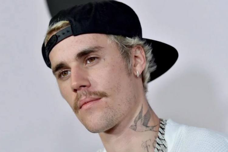 Justin Bieber húszmillió dollárra perli az őt szexuális zaklatással vádoló nőket